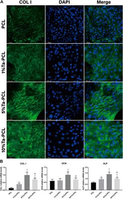 Tantalum Nanoparticles Reinforced PCL Scaffolds Using Direct 3D Printing for Bone Tissue Engineering